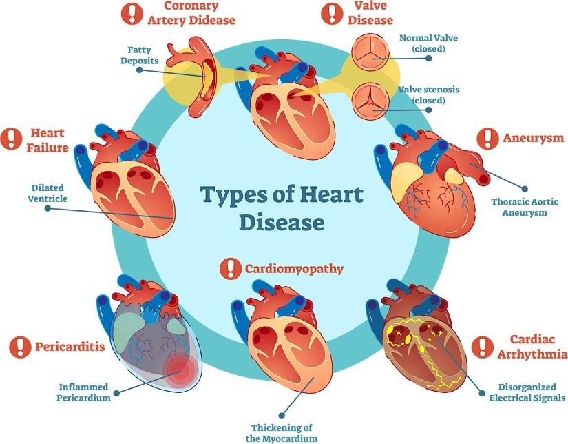 Spot Heart Disease Causes